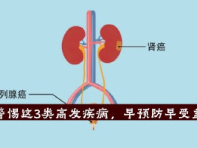 提醒老年人，要警惕这3类高发疾病，早预防早受益